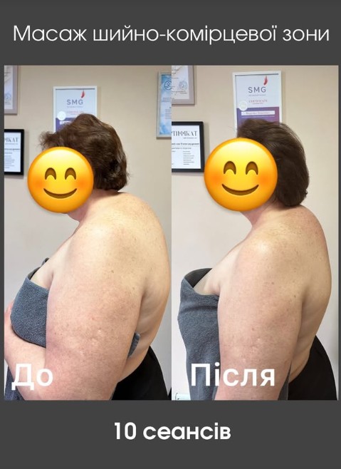 Vrat i držanje — prije i poslije